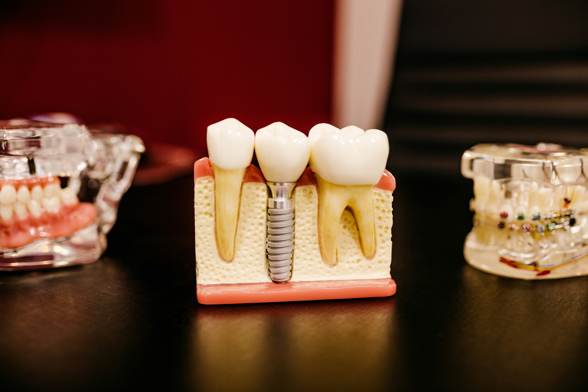 Atif Dental Clinic Specialist